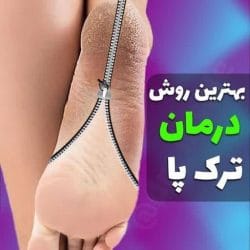 جوراب سیلیکونی ژله ای درمان ترک پا