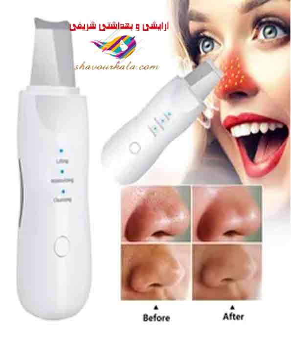 اتو پوست درما اف التراسونیک شاول اصلی ،اورجینال Ultrasonic Shovel
