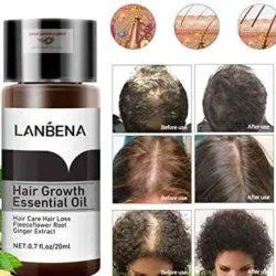 سرم و یا قطره ضد ریزش مو  لانبنا  LANBENA  اصلی